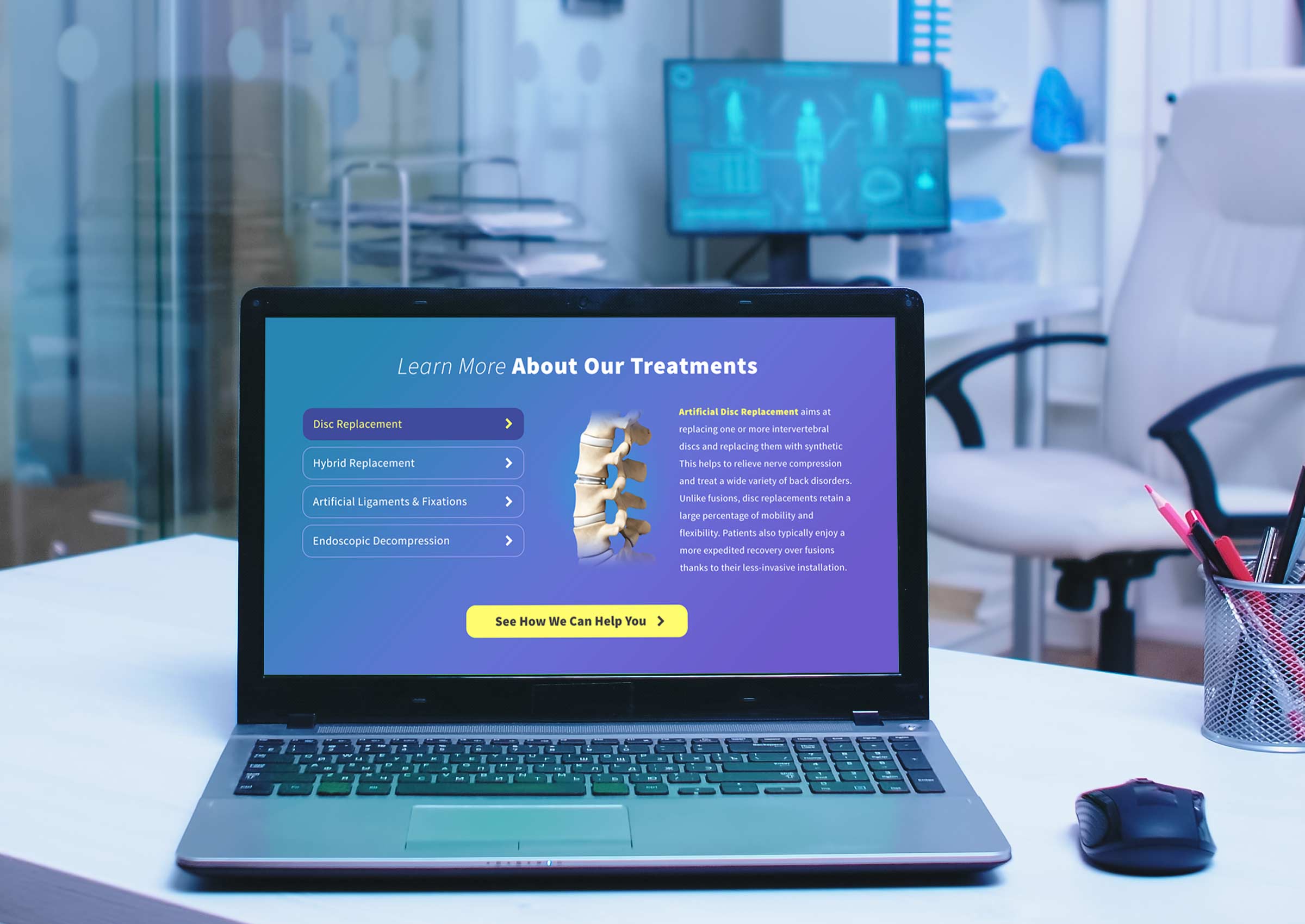 Laptop in Doctor's Office showing Disc Replacement website